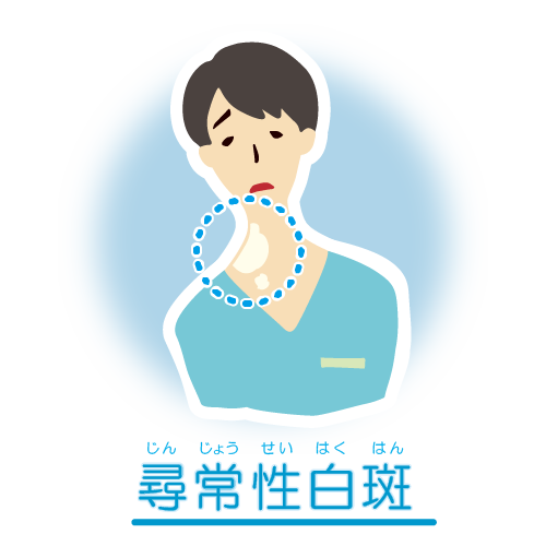 尋常性白斑の皮膚症状を示すイラスト
